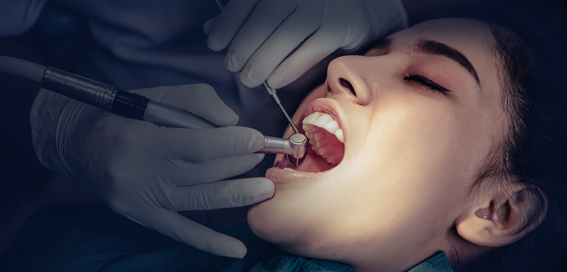 La nostra clinica dentale: prezzi competitivi per gli impianti dentali, senza bisogno di cercare altrove